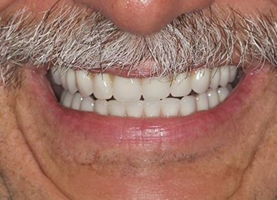 Before — Full Makeover