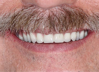 Before — Full Makeover
