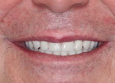 Before — Full Makeover