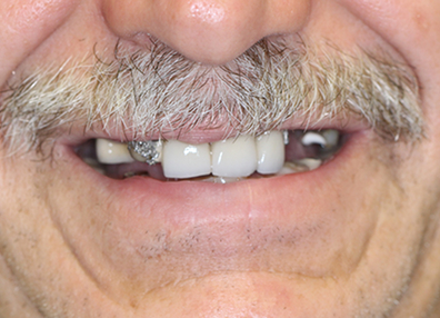 After — Full Makeover