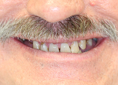 After — Full Makeover