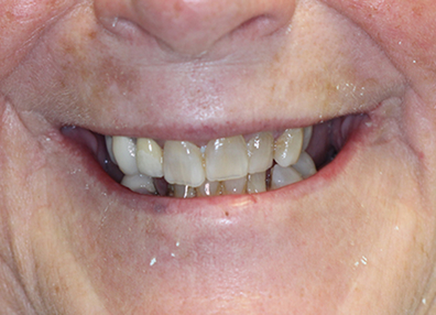 After — Full Makeover
