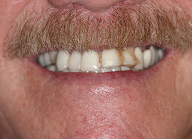 After — Full Makeover
