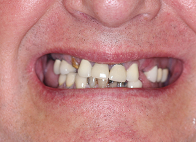 After — Full Makeover